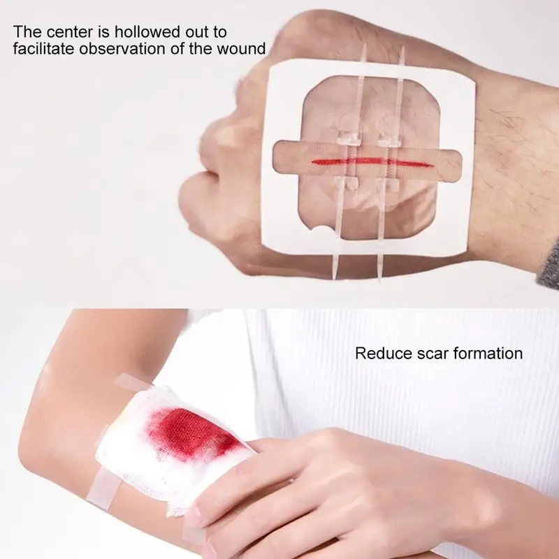 1/3/5pcs Zipper Tie Wound Closure Patch Hemostatic Patch Wound Fast Suture Zipper Band-Aid Outdoor Portable